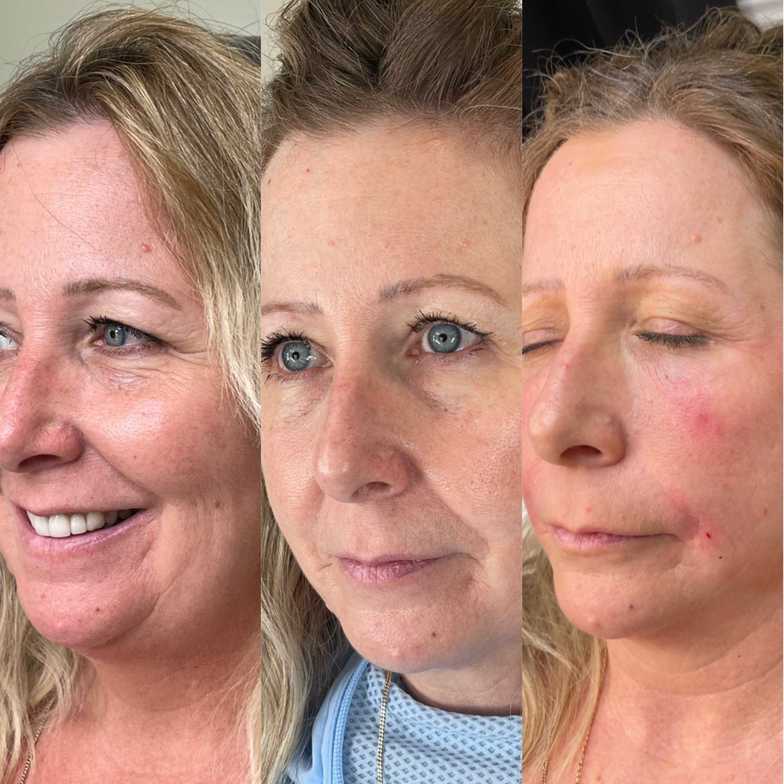 Results | BC Cosmetics