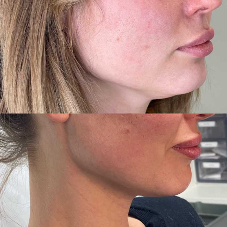 Results | BC Cosmetics