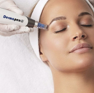 Link to: /programs/prp-microneedling